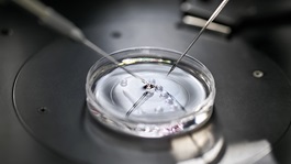 Process of in vitro fertilization in laboratory